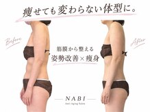 ナビ(NABI)