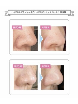 サロンドール(SalonDoll)/