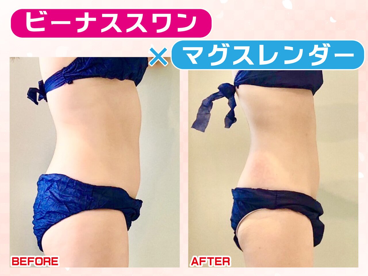 神戸で唯一【ヴィーナスディーバ】世界特許マシンで断然結果が違う