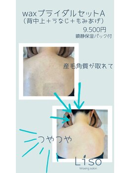 リソ ワキシング サロン(Liso waxing salon)/Waxブライダルセット