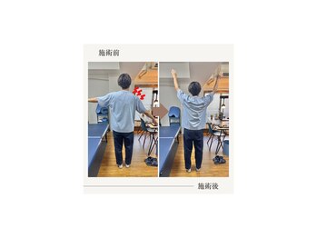 バレルメディカル研究所 恵比寿/肩の痛みで腕が上がらない