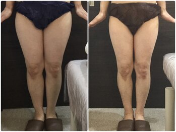 美容整体ウェリナ あま甚目寺院/小顔矯正/骨盤矯正/美脚サロン