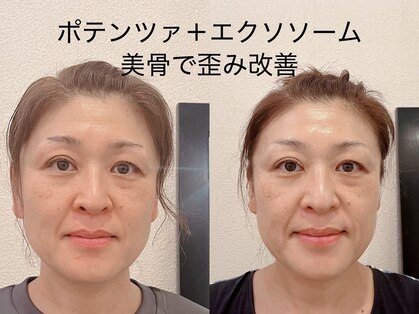 ナチュラルセラピー ドロップ(Drop)の写真