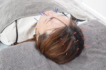 アキュリラ(Acurela)