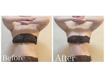 リブ 三軒茶屋(LiB)/イベントや撮影等に向けてケア