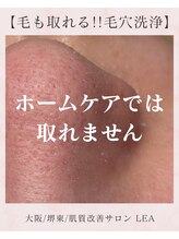 レア(Lea)/無理なケアが悩みを悪化させます