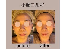 ユフラ
