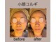 ユフラの写真