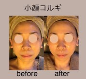 ユフラ