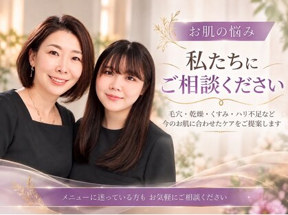 アンヘル(Angel)の写真