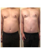 レナンセラ バイ カトレアグループ(Renanthera by カトレアGroup)/40代男性Before After