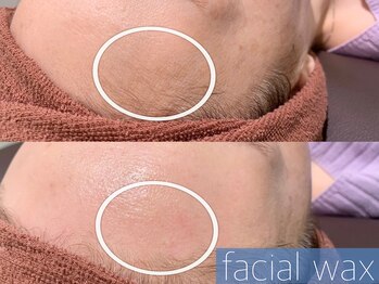 レーヴ(REVE)/フェイシャルワックス（生え際）