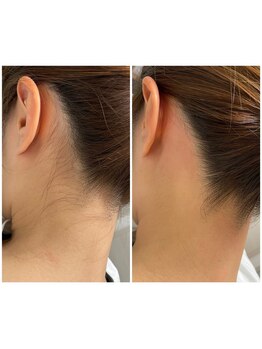 ミーミドットアイ(Mi-mi.i)/うなじワックス