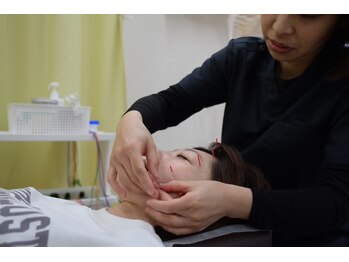 ふくみみ鍼灸接骨院/美容鍼