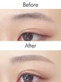 アイム 八王子店(i'm)&nbsp;【Before→After】
