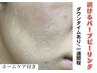 DT有りハーブピーリング/お得なホームケアアイテム付き♪