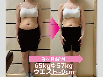 緑の杜整体院/30代、痩せたくても痩せなかった