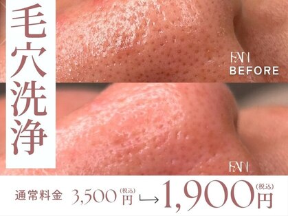 ファン(FAN)の写真