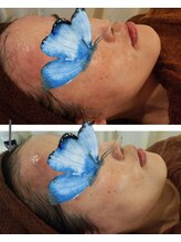 エステサロン カラーズ(COLORS)/敏感肌の肌質改善も得意♪