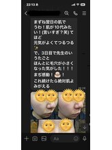 前田鍼灸接骨院/『長崎 美容鍼』ダーマ鍼