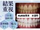 ハリト 熊本 上通り水道町(HaRi&)の写真