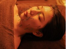 エウーゴ整骨院の雰囲気（美容鍼も完全個室の部屋で女性スタッフが対応します。男性もOK）