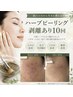 肌質改善☆顔ハーブピーリング・剥離あり ヒト幹細胞導入¥15,000→¥11,000