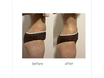 マルレ アイサロン 三軒茶屋(MARLE eyesalon)/便秘悩みに