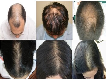 おはな整骨院/頭髪でお悩みの方は・・・