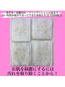 フェミニー(Feminy)/お顔の汚れ除去