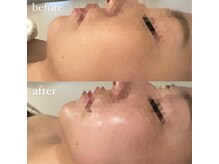 小顔の確かな技術を行っております。