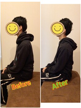 うちんだい整骨院 整体院/30代男性/猫背矯正 施術事例