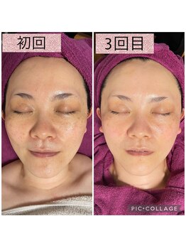 ビューティーサロン キャンディ 海老名(Candy)/