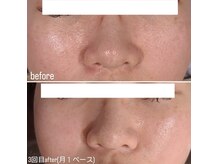 シス(SiS.)/ホームケア×月１ハーブ