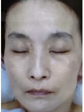 サナティオ(SANATIO)/DXコース