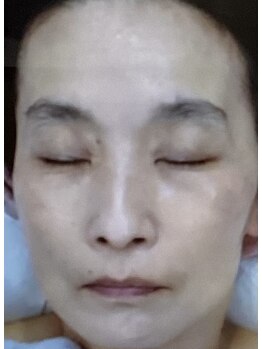 サナティオ(SANATIO)/DXコース