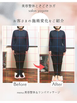 ヨギート(yogate)/整体/小顔/リンパマッサージ
