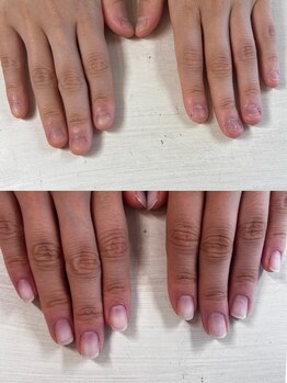 ヴェールリム(verl lim)/