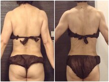 美容整体ウェリナ 名駅院/小顔矯正/骨盤矯正/美脚サロン 