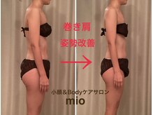 ミオ(mio)の雰囲気（ボディが変わればお顔も変わる！巻き肩/姿勢改善/ダイエット）