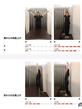 女性専用整体サロン　ベル 岩国店/ 【30代】姿勢Before After