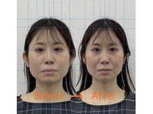 日進町整体院/30代女性　初回からの効果実感