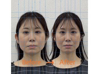 日進町整体院/30代女性　初回からの効果実感