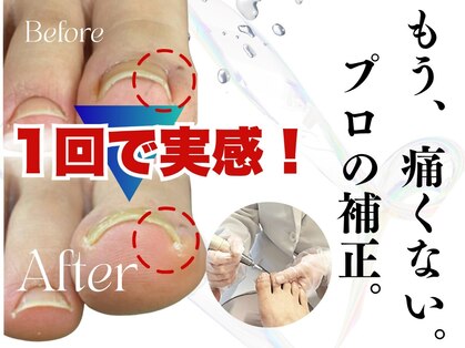 名古屋駅前巻き爪センターの写真