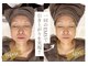 クール(Coeur)の写真