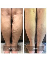 リラクゼーションルーム チュラ(Relaxation Room CERAH)/ソティル自宅ケア