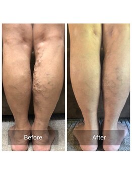 リラクゼーションルーム チュラ(Relaxation Room CERAH)/ソティル自宅ケア