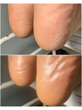 ネイル&アイラッシュ ルミア(Nail & Eyelash LUMIA)/韓国発☆角質フットケア