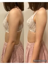 アネラ 京都駅前店(Anela)/【姿勢改善】Before & After