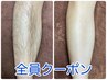 【全員・男性限定】全身脱毛（VIO・ヒップなし）¥1９，２５０